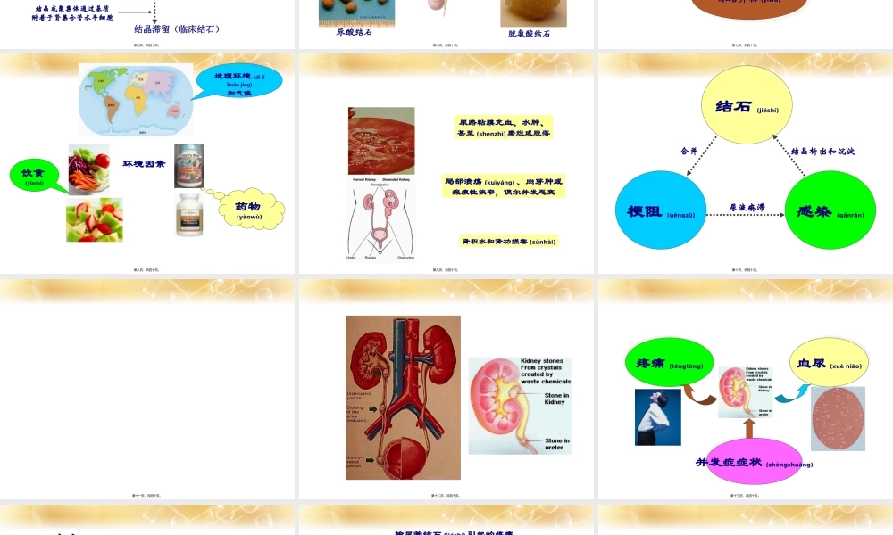 2022年医学专题—泌尿系结石(1).ppt