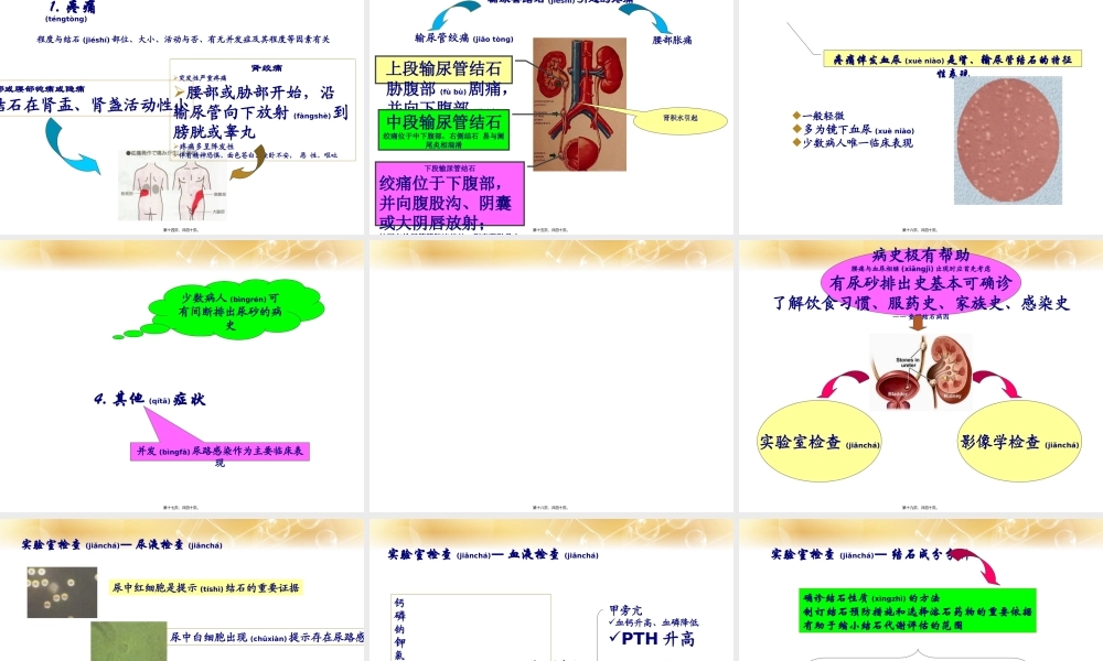 2022年医学专题—泌尿系结石(1).ppt