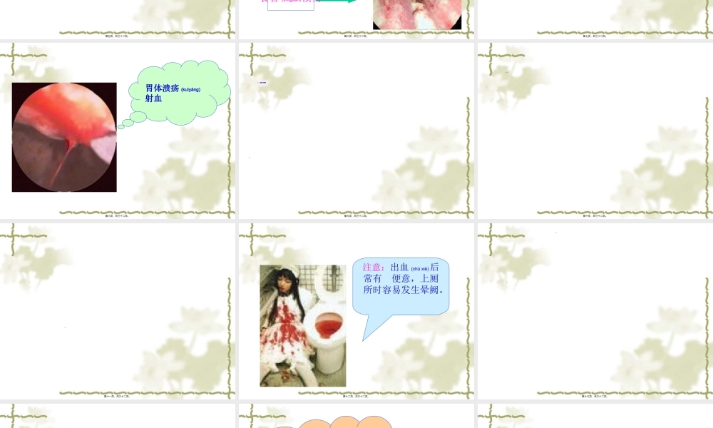 2022年医学专题—上消化道大出血的(1).ppt