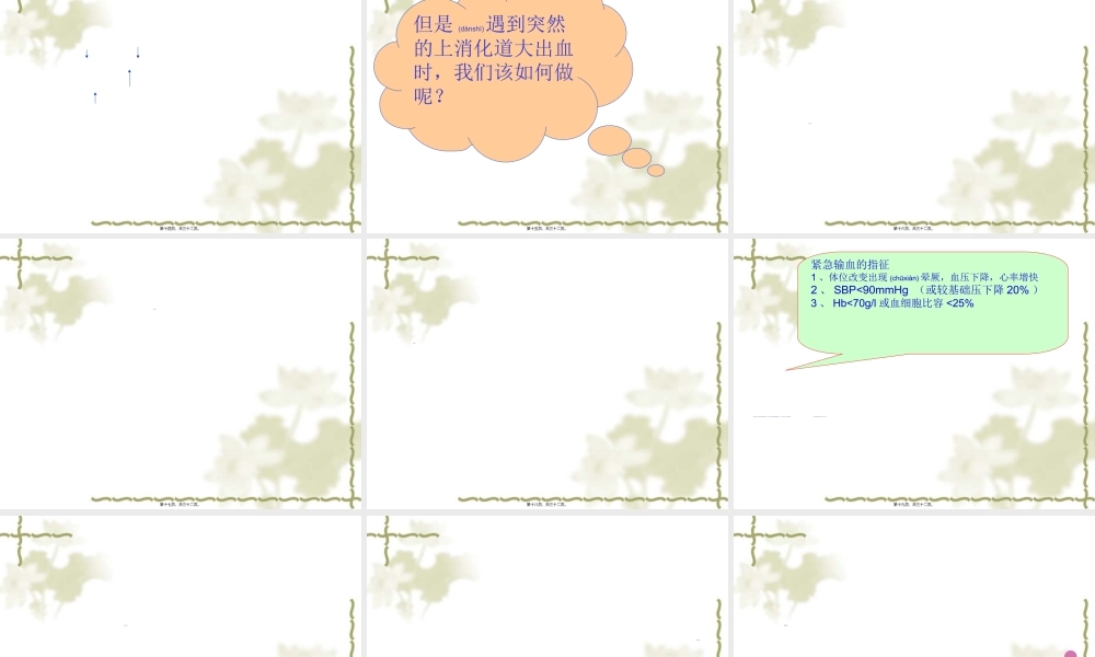 2022年医学专题—上消化道大出血的(1).ppt