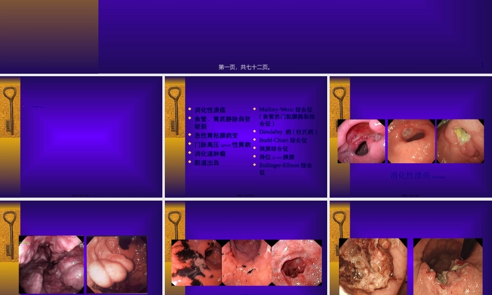 2022年医学专题—上消化道出血的诊治(1).ppt