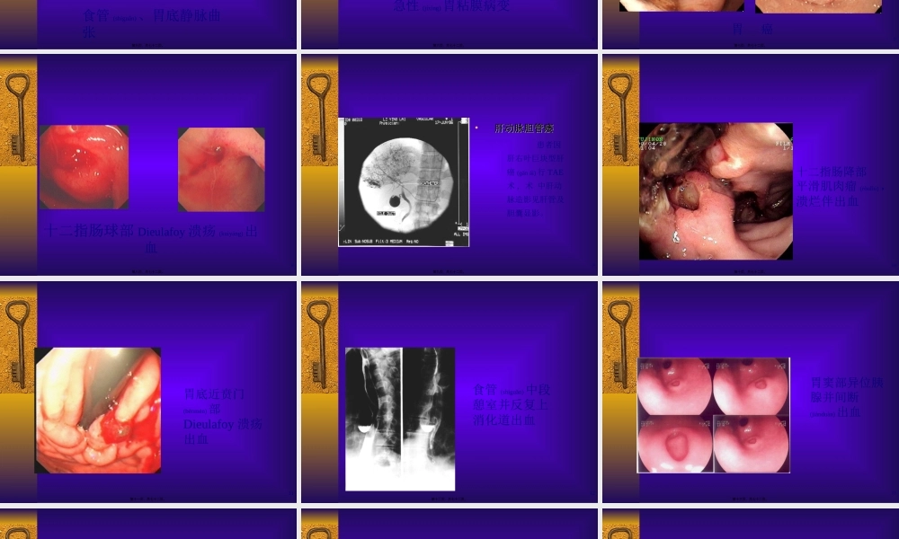 2022年医学专题—上消化道出血的诊治(1).ppt