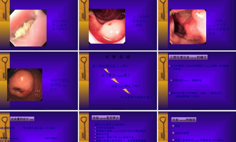 2022年医学专题—上消化道出血的诊治(1).ppt