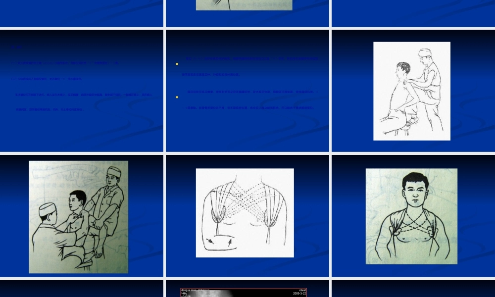 2022年医学专题—上肢骨、关节损伤1(1).ppt