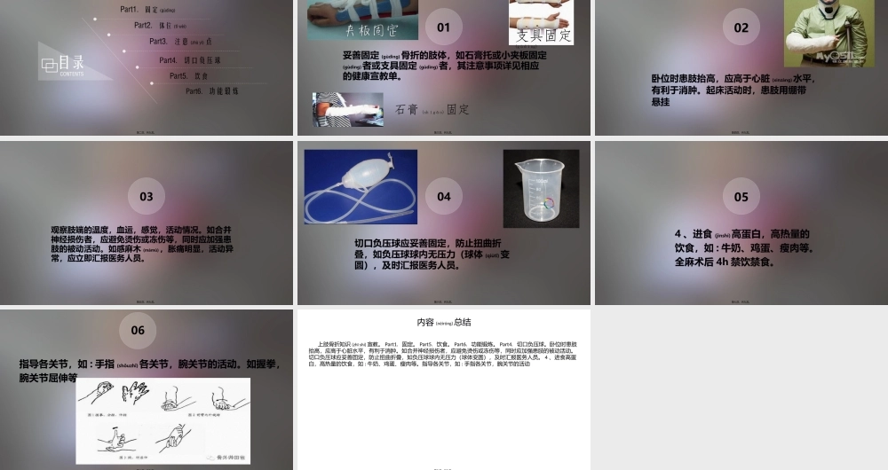 2022年医学专题—上肢骨折(1).pptx