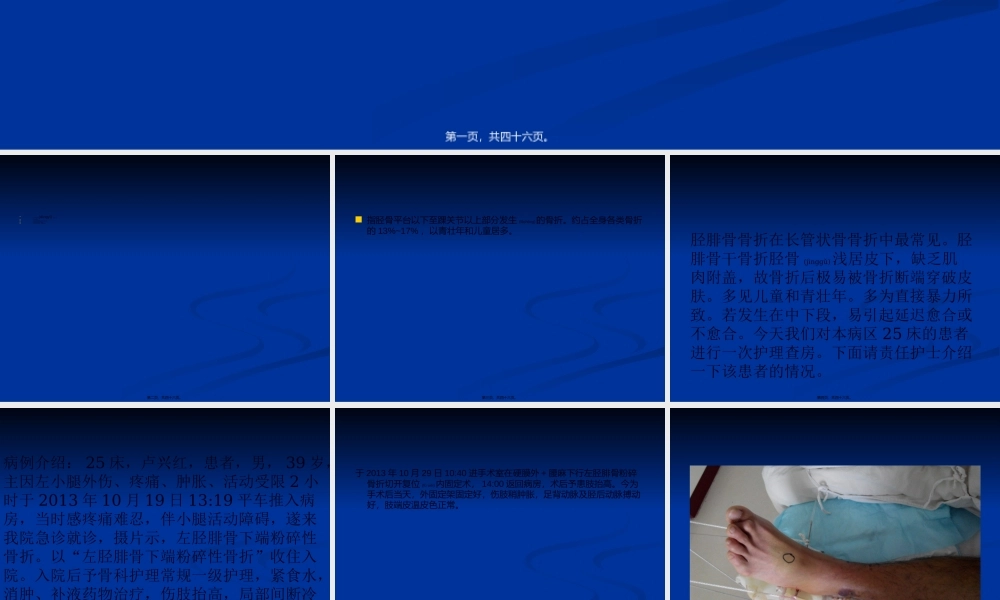 2022年医学专题—业务查房-(胫腓骨骨折)(1).ppt