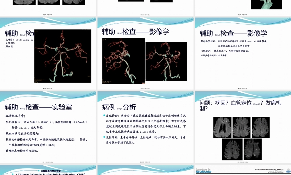 2022年医学专题—中国缺血性卒中亚型介绍(1).pptx