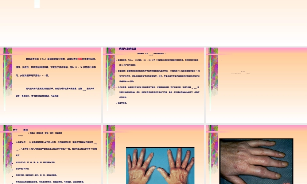 2022年医学专题—中山医科大学类风湿关节炎(1).ppt