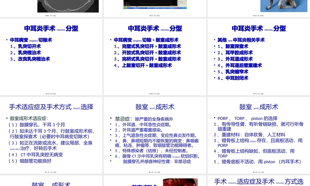 2022年医学专题—中耳炎规范化诊治思路(1).pptx