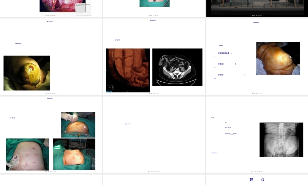 2022年医学专题—使用IPST补片的腹腔镜造口旁疝修补术(1).ppt