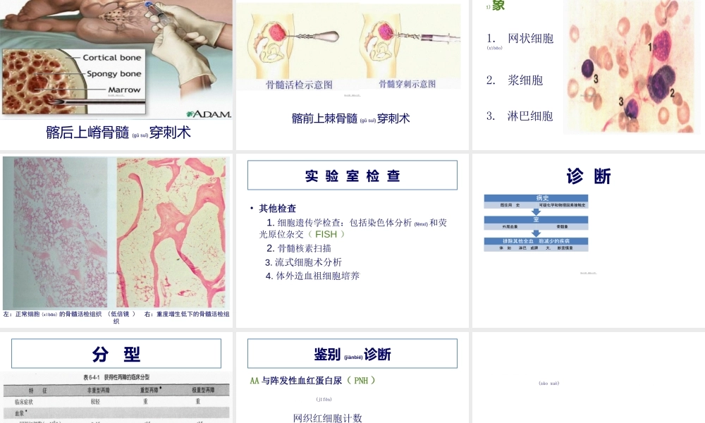 2022年医学专题—再生障碍性贫血(七年制)(1).ppt