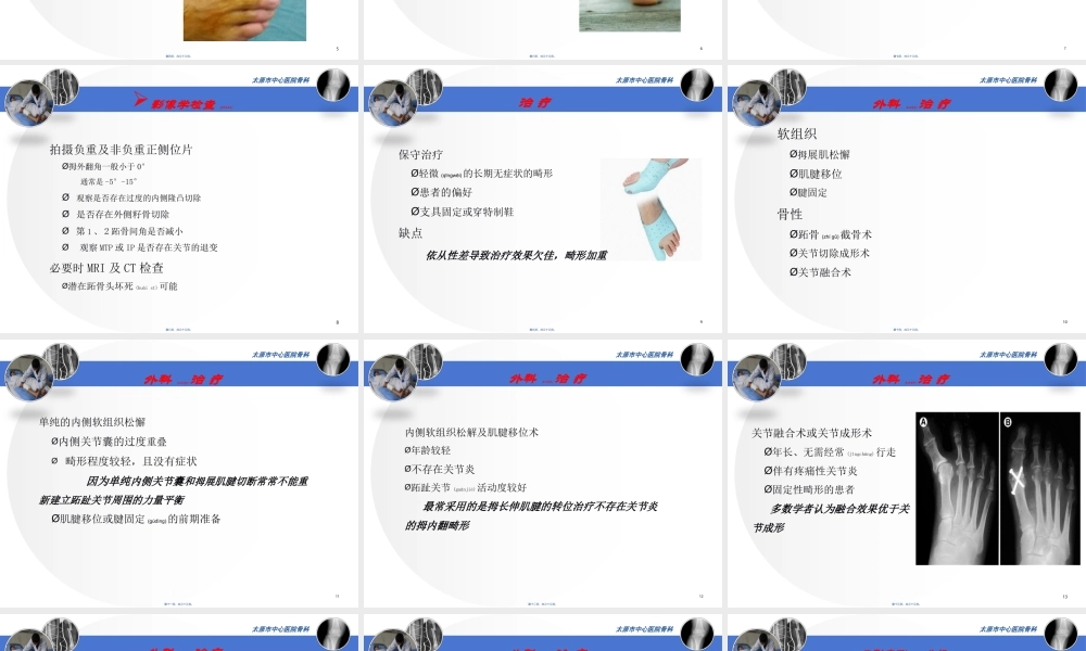 2022年医学专题—医源性拇内翻2015.11.1--杜虎羽(1).ppt