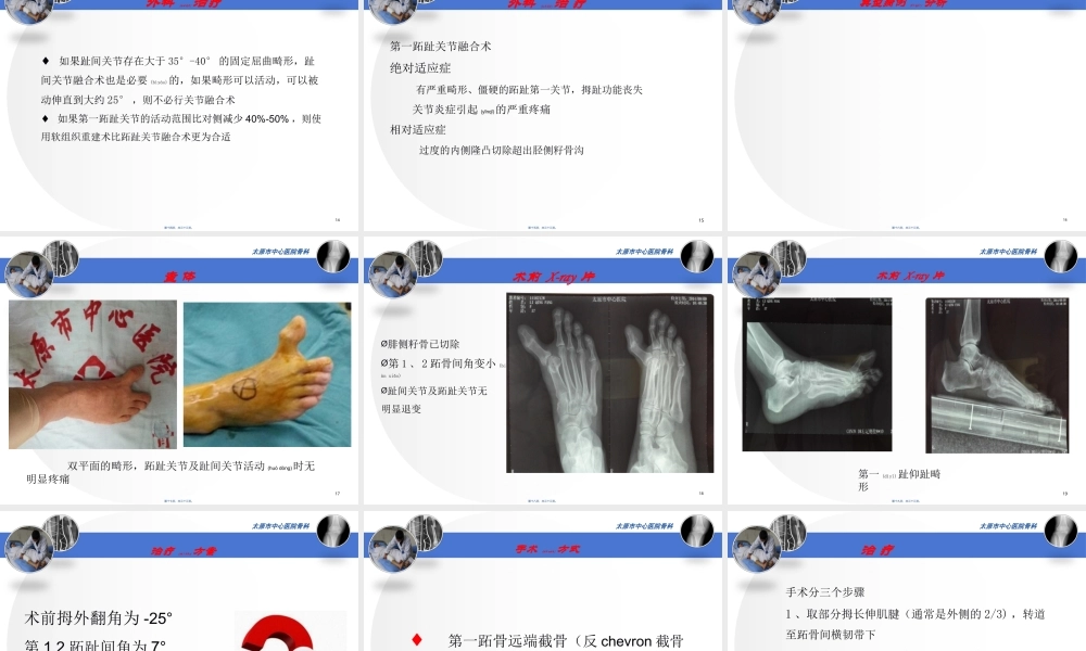 2022年医学专题—医源性拇内翻2015.11.1--杜虎羽(1).ppt