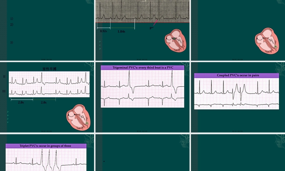 2022年医学专题—协和医科大学心电图详解(1).pptx
