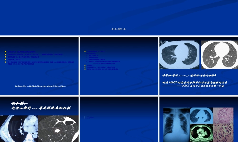 2022年医学专题—如何在肺内占位性病变中发现肺癌(1).ppt