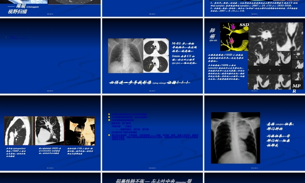 2022年医学专题—如何在肺内占位性病变中发现肺癌(1).ppt