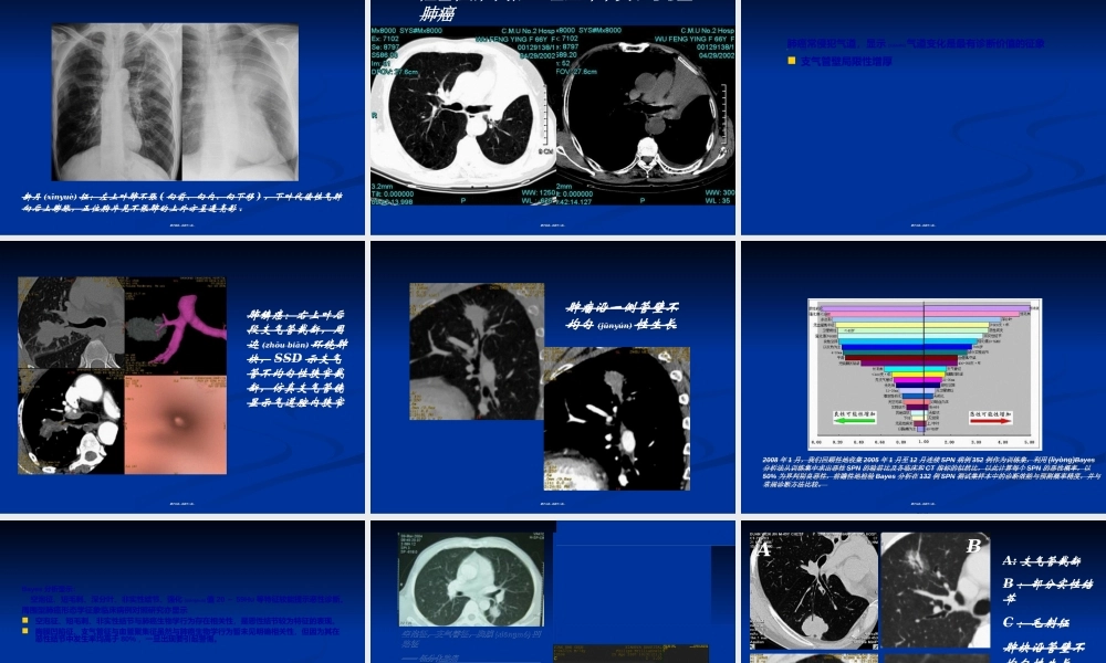 2022年医学专题—如何在肺内占位性病变中发现肺癌(1).ppt