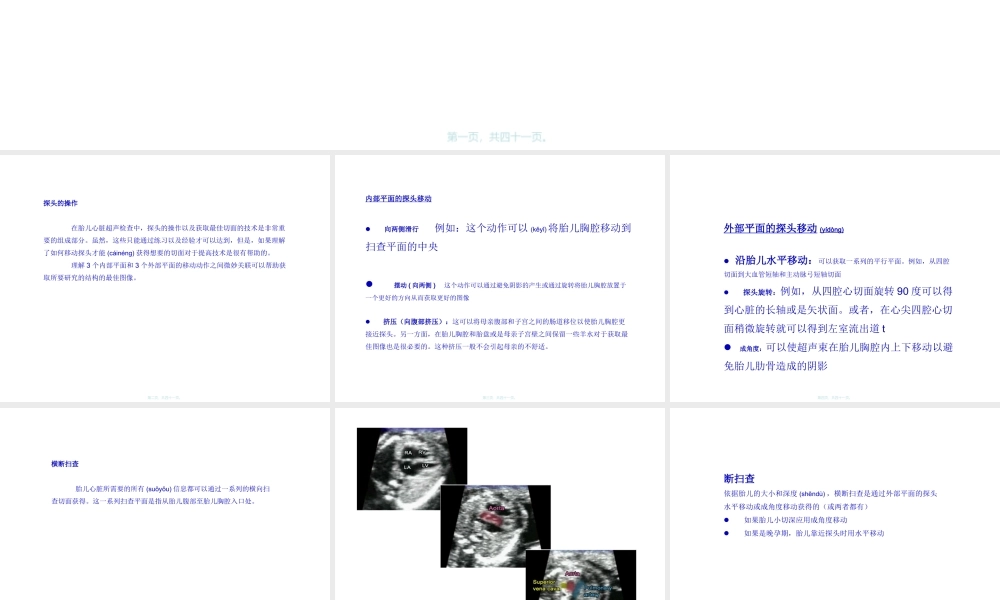2022年医学专题—如何获得胎儿心脏切面(1).ppt