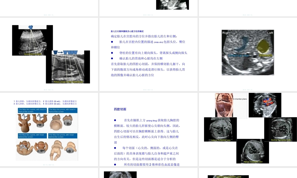 2022年医学专题—如何获得胎儿心脏切面(1).ppt