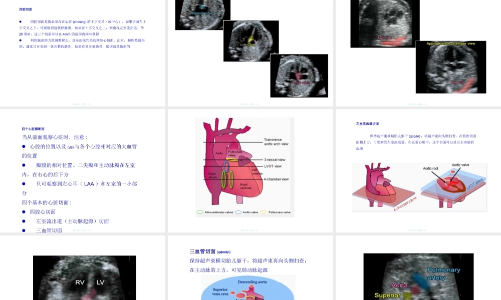 2022年医学专题—如何获得胎儿心脏切面(1).ppt