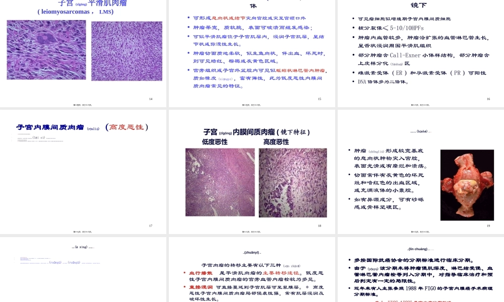 2022年医学专题—子宫肉瘤诊疗指南(1).ppt