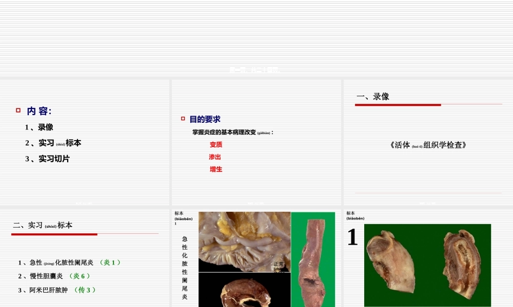 2022年医学专题—实习05-炎症1(1).ppt