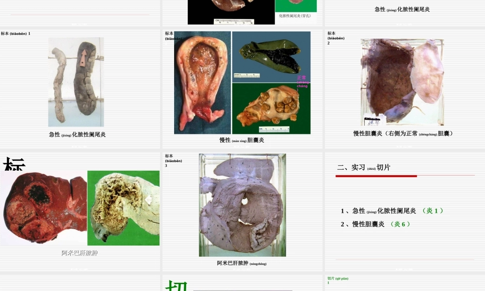 2022年医学专题—实习05-炎症1(1).ppt