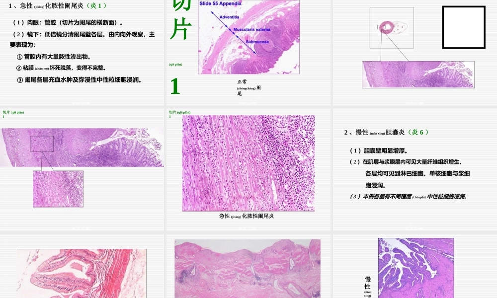2022年医学专题—实习05-炎症1(1).ppt