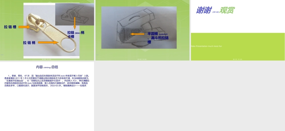 2022年医学专题—宿舍OT病例分析(1).ppt