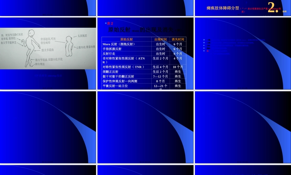 2022年医学专题—小儿脑瘫的康(1).ppt