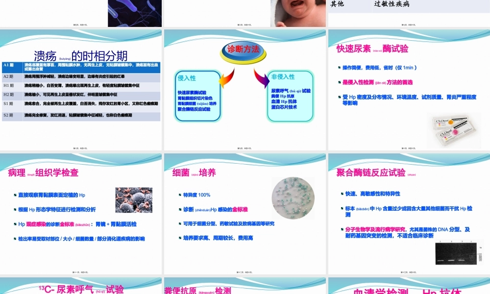 2022年医学专题—幽门螺杆菌感染(1).pptx