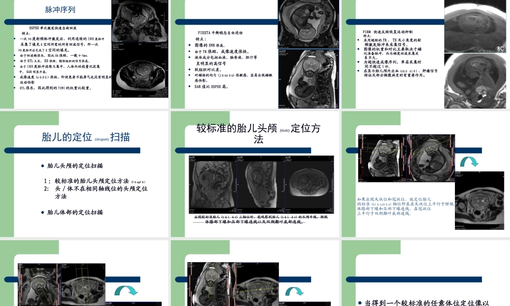 2022年医学专题—影像学中胎儿磁共振成像技术(1).ppt