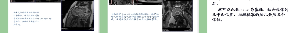 2022年医学专题—影像学中胎儿磁共振成像技术(1).ppt