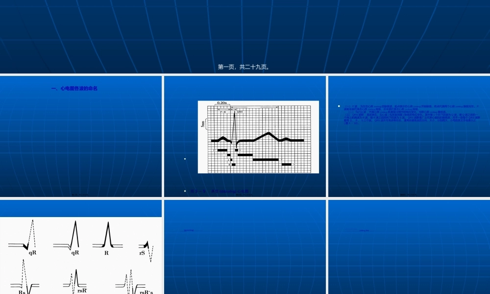 2022年医学专题—心肌细胞动作电位与心电图的关系(1).ppt