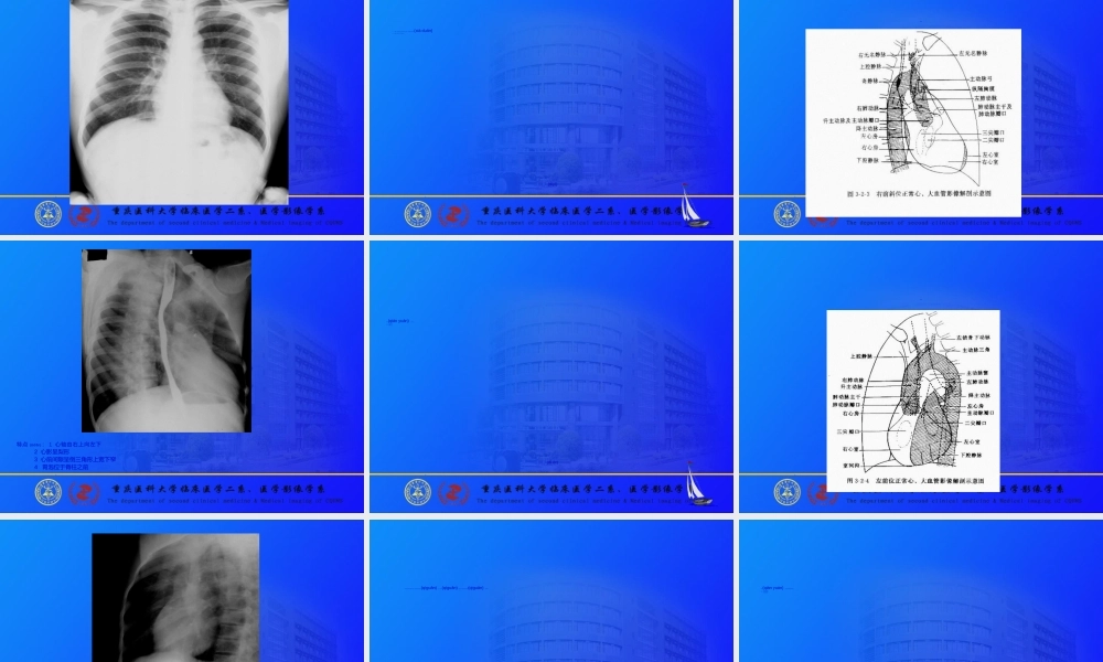 2022年医学专题—心脏与大血管ppt(1).ppt