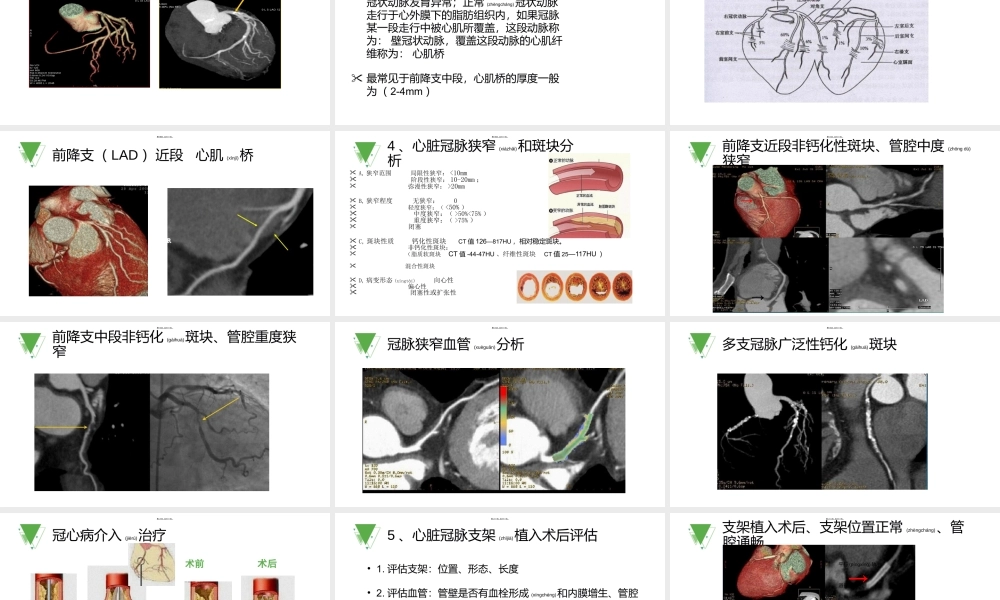 2022年医学专题—心脏冠脉CTA(1).ppt