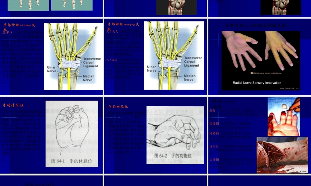 2022年医学专题—手外伤及断肢(指)再植(1).ppt