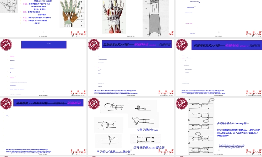 2022年医学专题—手外科肌腱缝合(1).ppt