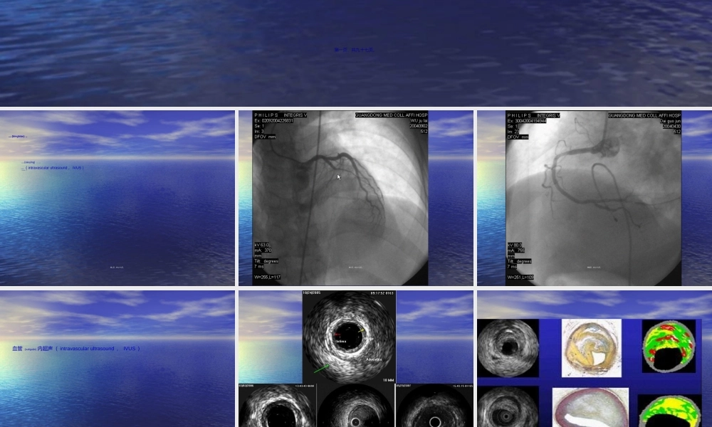 2022年医学专题—排螺旋CT的冠状动脉成像(1).ppt