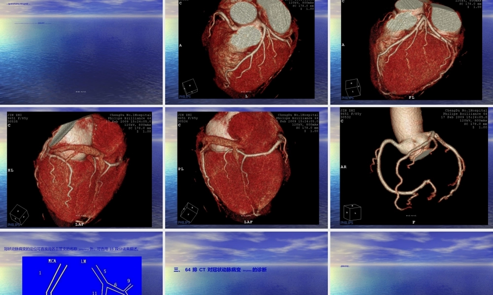 2022年医学专题—排螺旋CT的冠状动脉成像(1).ppt