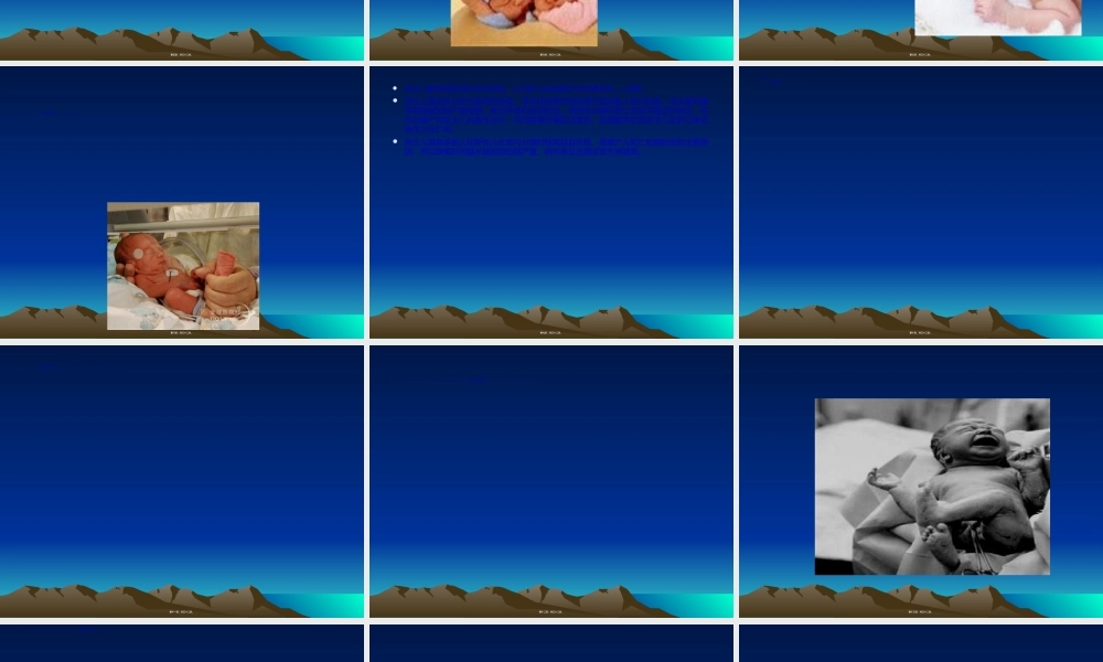 2022年医学专题—新生儿死亡死亡病例的分析(1).ppt