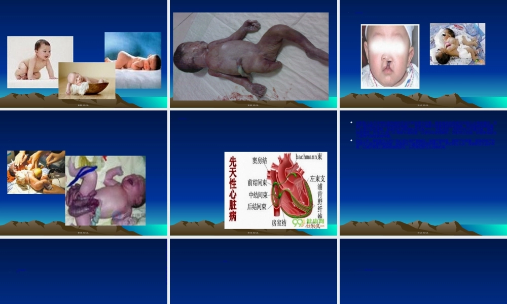 2022年医学专题—新生儿死亡死亡病例的分析(1).ppt