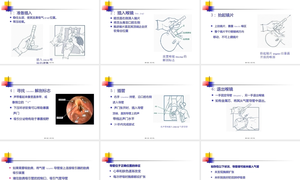 2022年医学专题—新生儿气管插管术-林冻冰(1).ppt