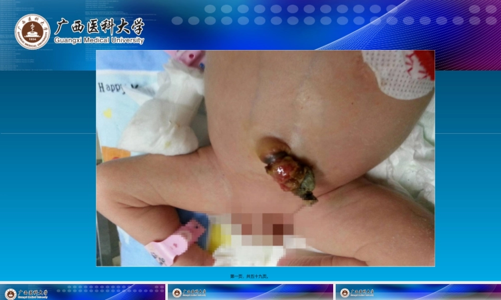 2022年医学专题—新生儿败血症(1).ppt