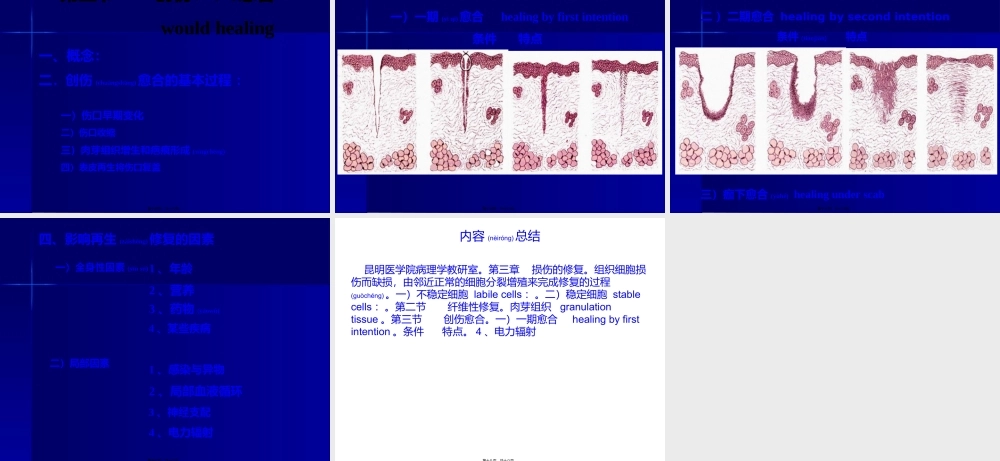 2022年医学专题—新生的毛细血管增生的纤维母细胞一定量的炎性细胞肉芽组织的结构(1).ppt