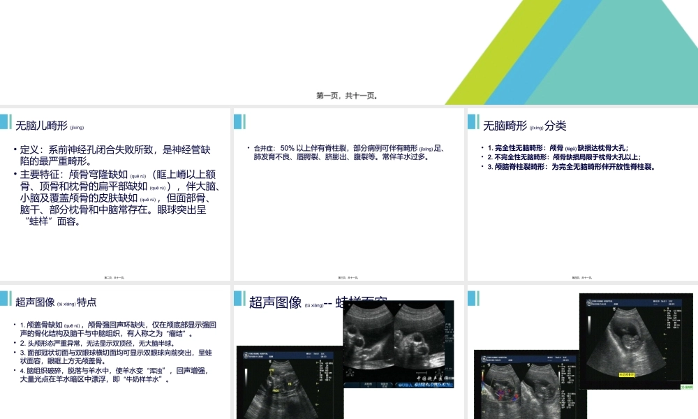 2022年医学专题—无脑儿(1).ppt