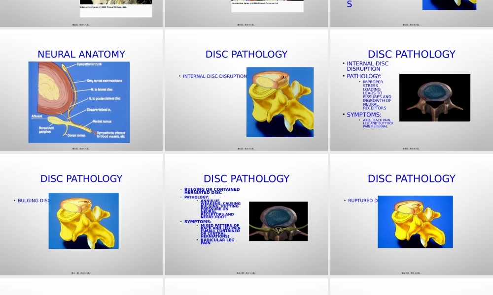 2022年医学专题—椎间盘源性下腰痛诊治(1).pptx