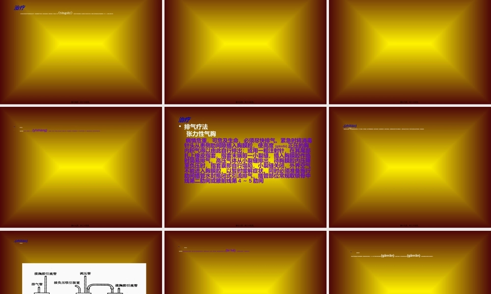 2022年医学专题—气------胸(1).ppt
