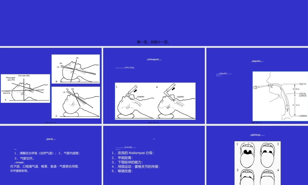 2022年医学专题—气管插管及困难气道(1).ppt