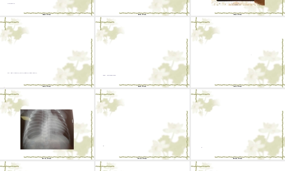 2022年医学专题—气胸病例讨论(1).ppt